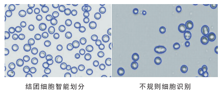 細(xì)胞計數(shù)儀細(xì)胞劃分圖片